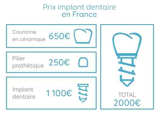 How much does a dental implant cost for one tooth?