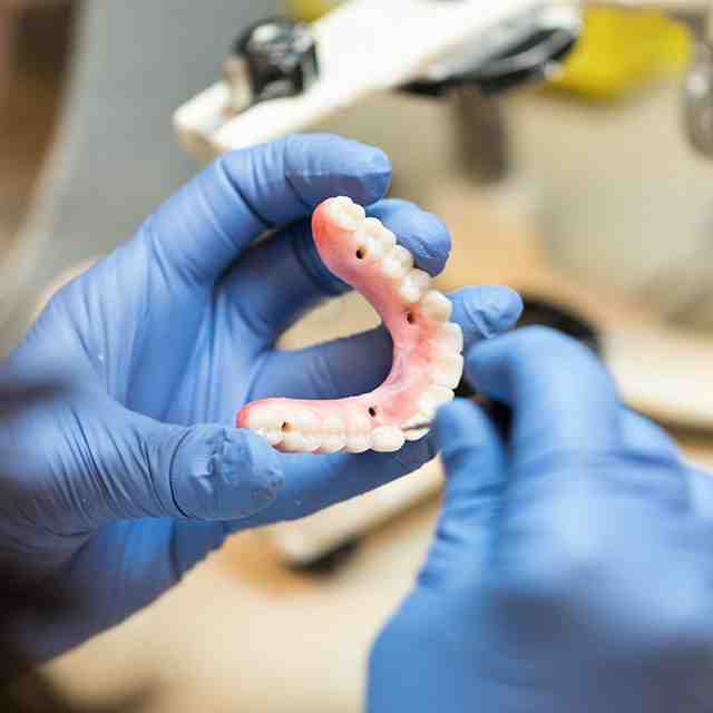 How much for clear choice dental implants Dental News Network