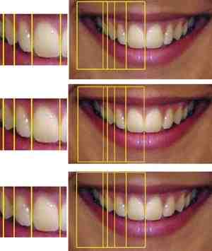 Is cosmetic dentistry grants real?