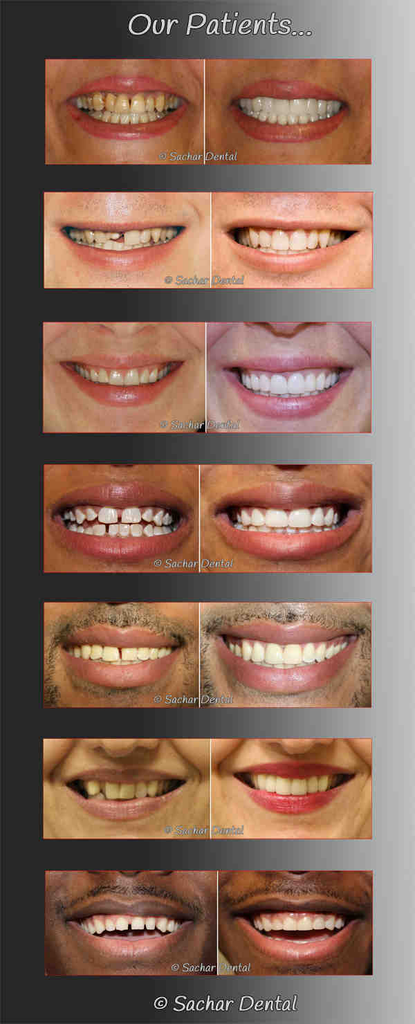 What are the most popular cosmetic dental procedures?