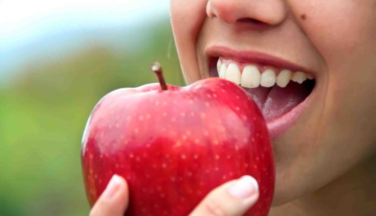 What can i eat one month after dental implants