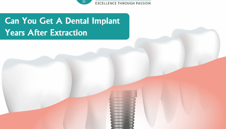 What happens if i don't get a dental implant