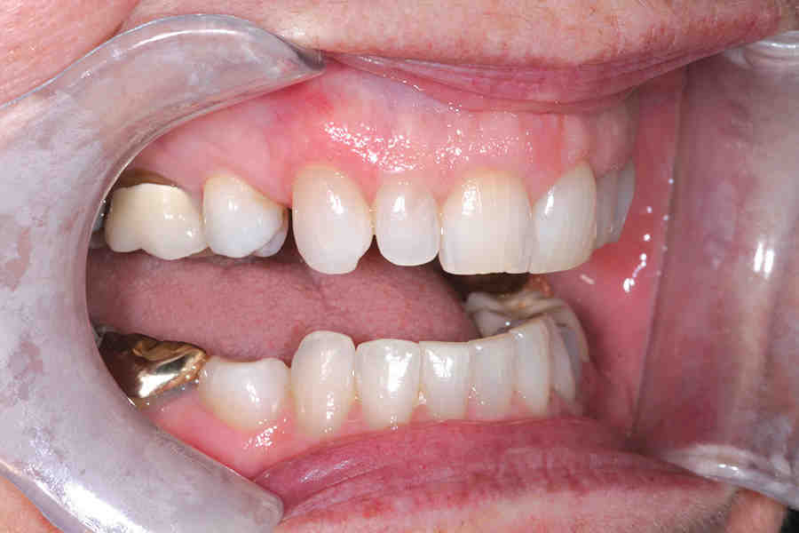 What is cosmetic dentistry services?