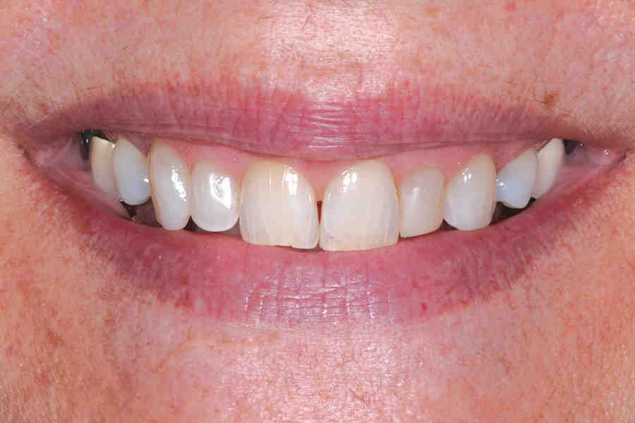 What is cosmetic dentistry services?