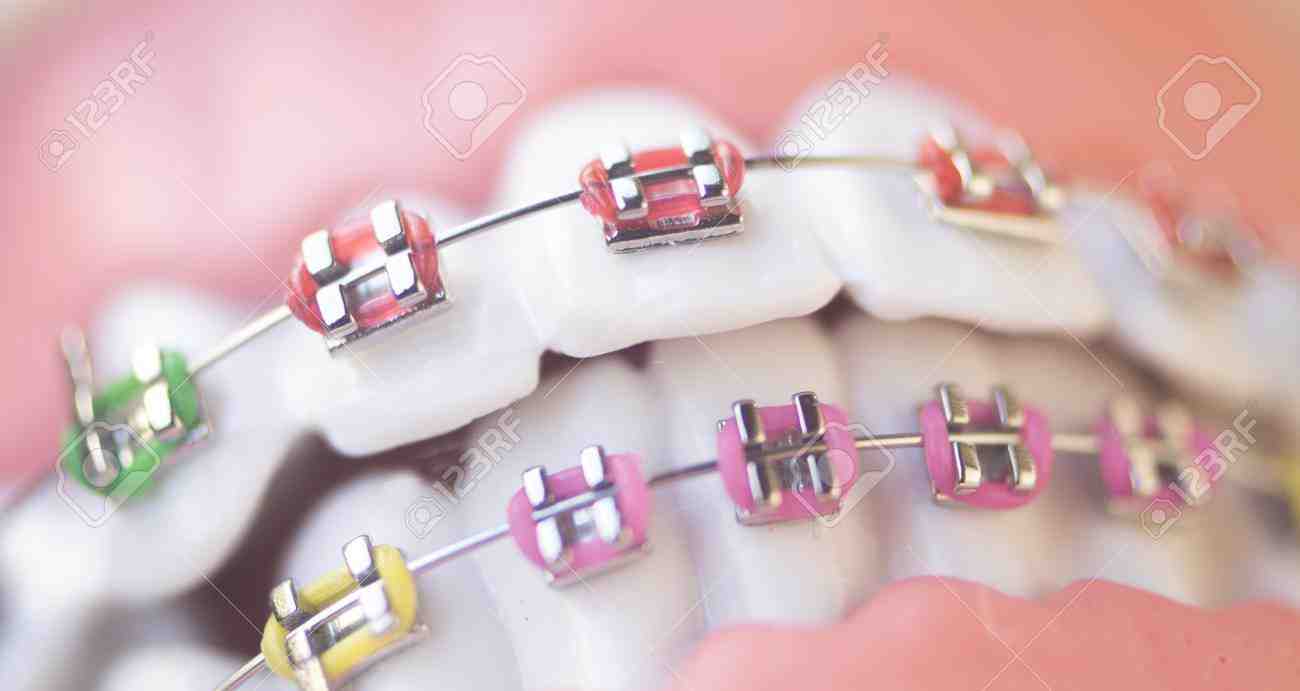 Cosmetic dentistry orthodontics Dental News Network