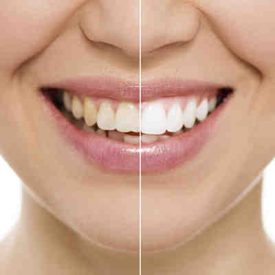 What is the difference between a dentist and a cosmetic dentist?