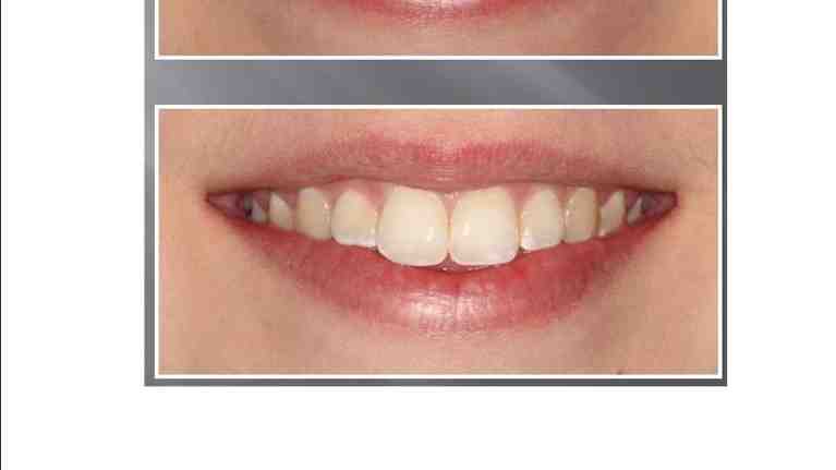 What is the difference between a dentist and a cosmetic dentist?