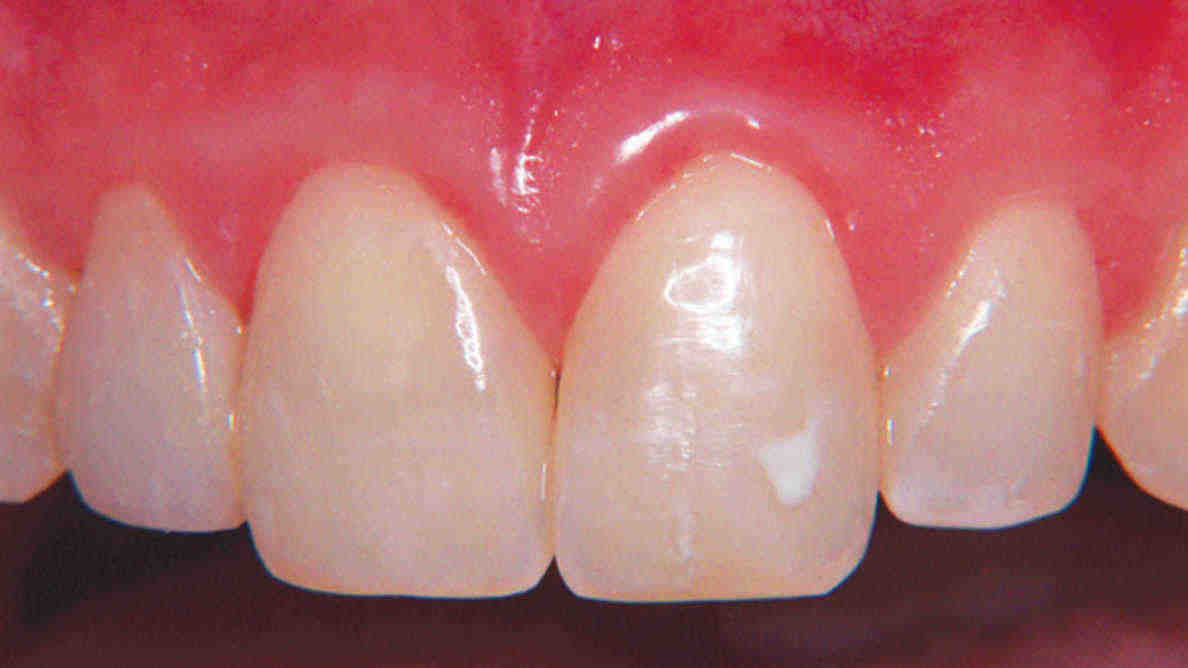 What procedures are included in cosmetic dentistry?