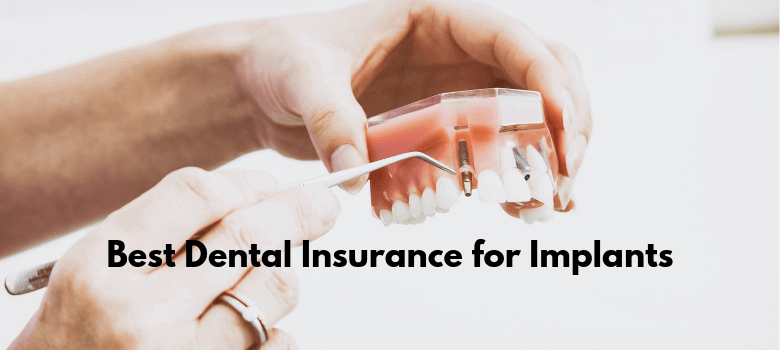 Which dental implant system is the best?