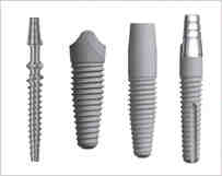 Which tooth implant is the best?
