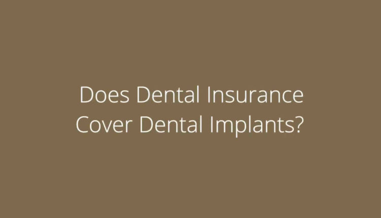 Are dental implants covered by dental insurance