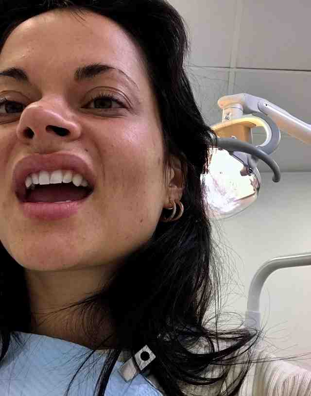 Cosmetic dentistry vampire fangs Dental News Network