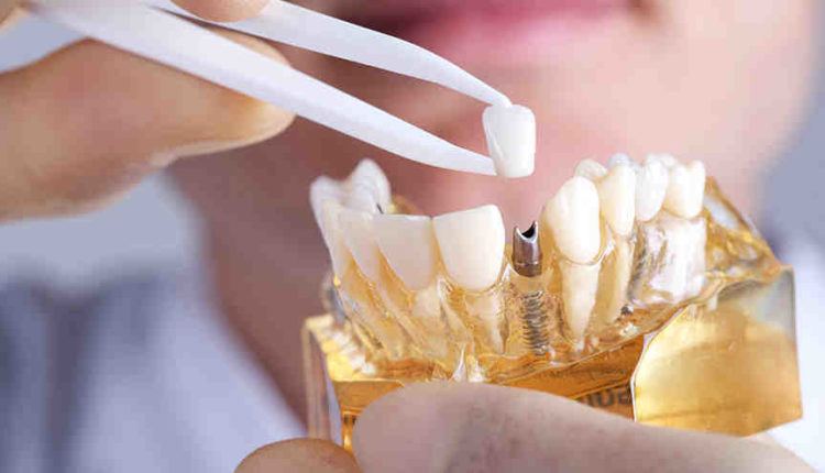 Can a dental implant cause lightheadedness
