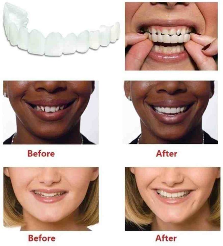 Cosmetic dentistry shark teeth Dental News Network