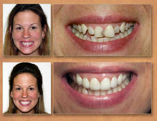 Can dentist trim your teeth?