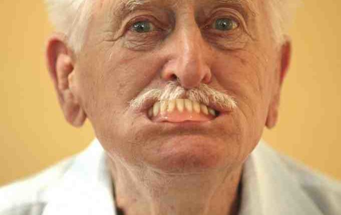 Can someone with osteoporosis have dental implants