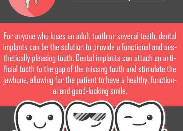 Can you feel dental implants