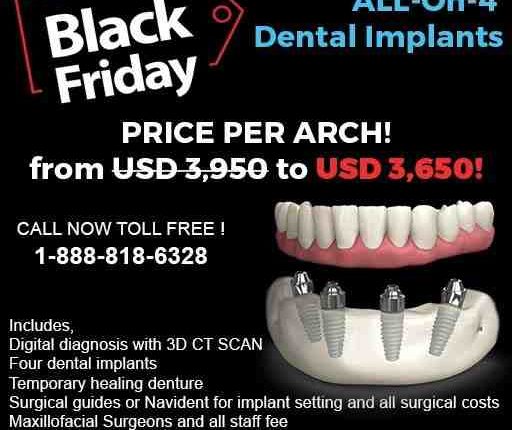 Can you get ceramic dental implants in mexico?