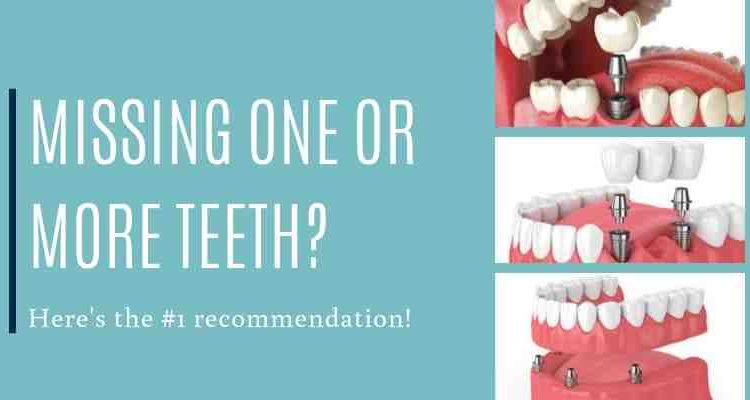 Can you get dental implants if you have no teeth