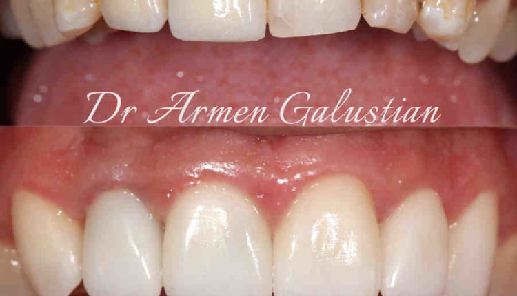 Cosmetic dentistry size shape color