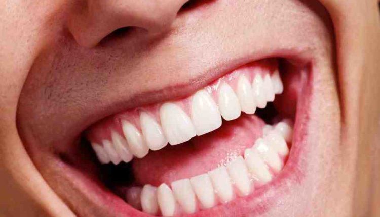 Cosmetic dentistry snohomish county