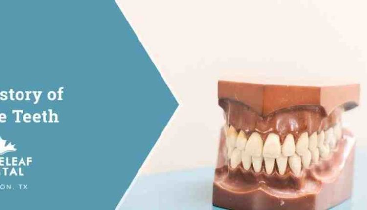 Cosmetic dentistry suppy