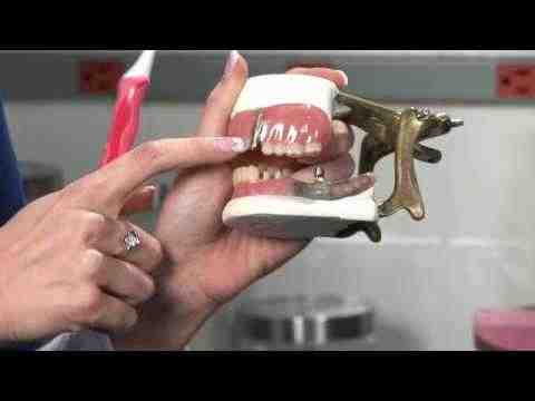 Do dental implants need special cleaning?