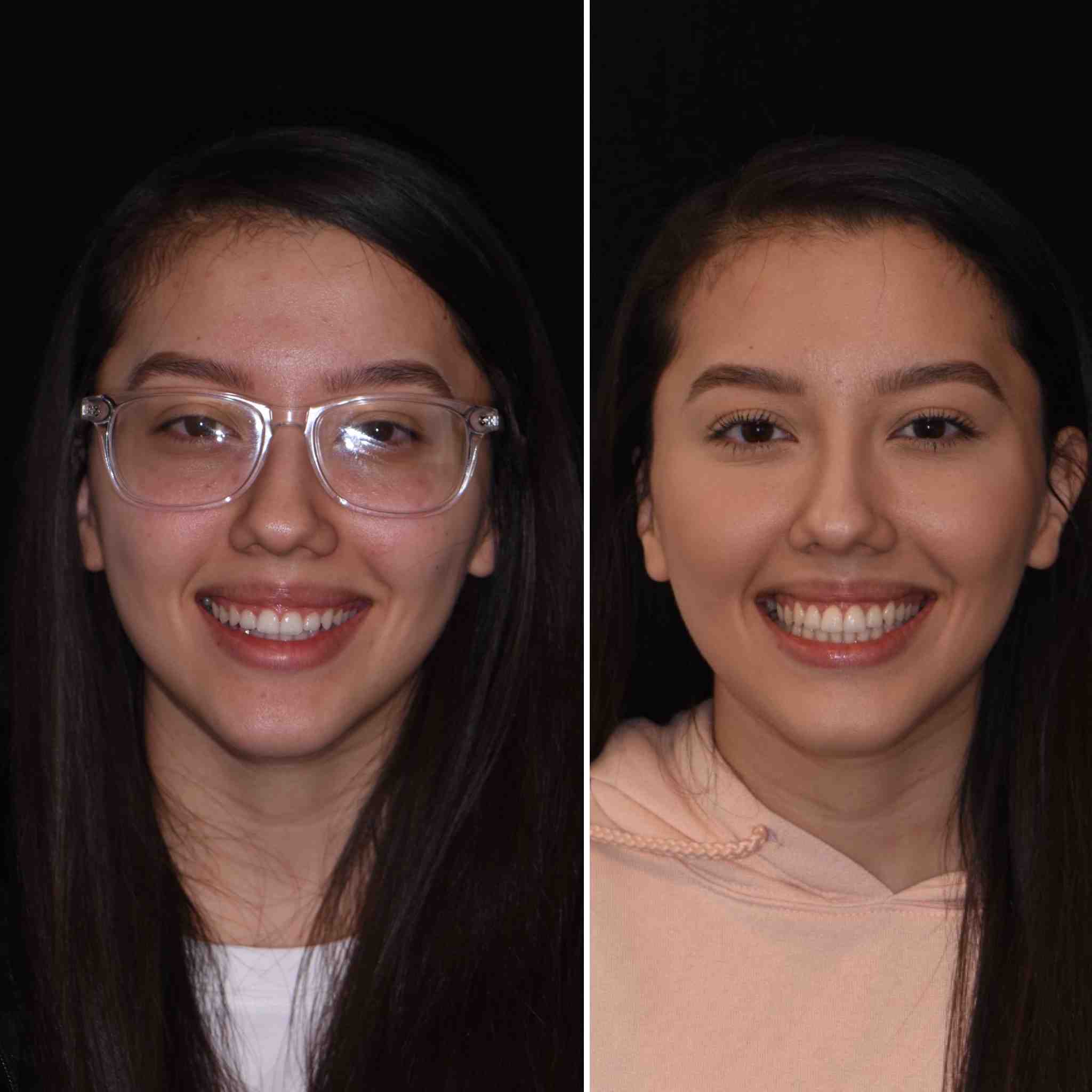 Do dental schools offer free dental work?