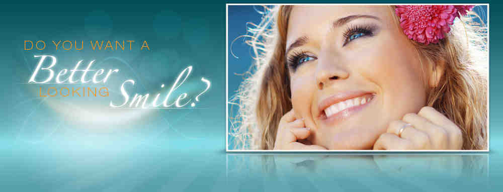 Do most celebrities have veneers?