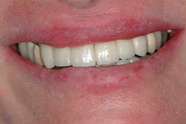 Do most dentists accept Delta Dental?