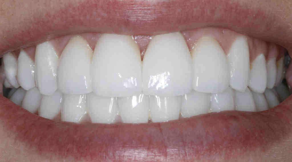Cosmetic dentistry reddit Dental News Network