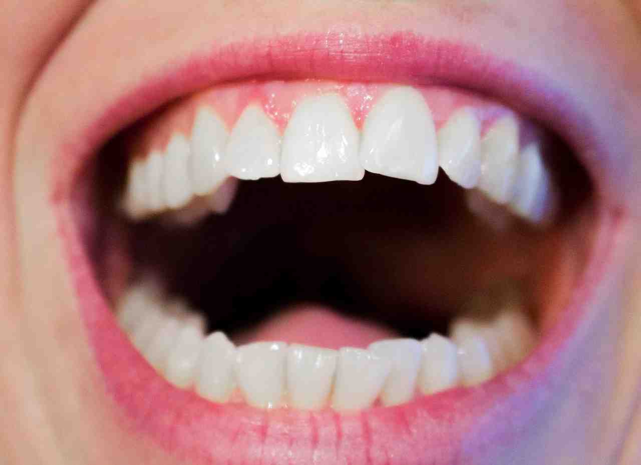Does insurance cover mini dental implants?