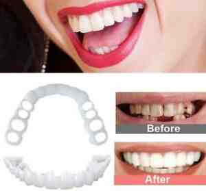 Does snap on smile straighten teeth?