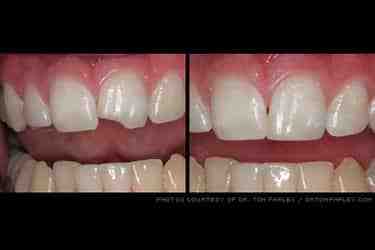 How can I improve my smile with cosmetic dentistry?