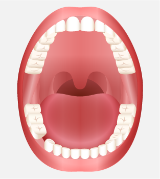 How do I choose a dental implant specialist?