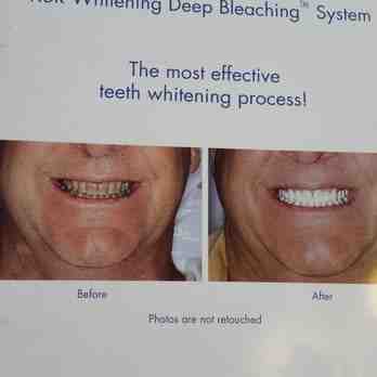 How do I find a reputable cosmetic dentist?