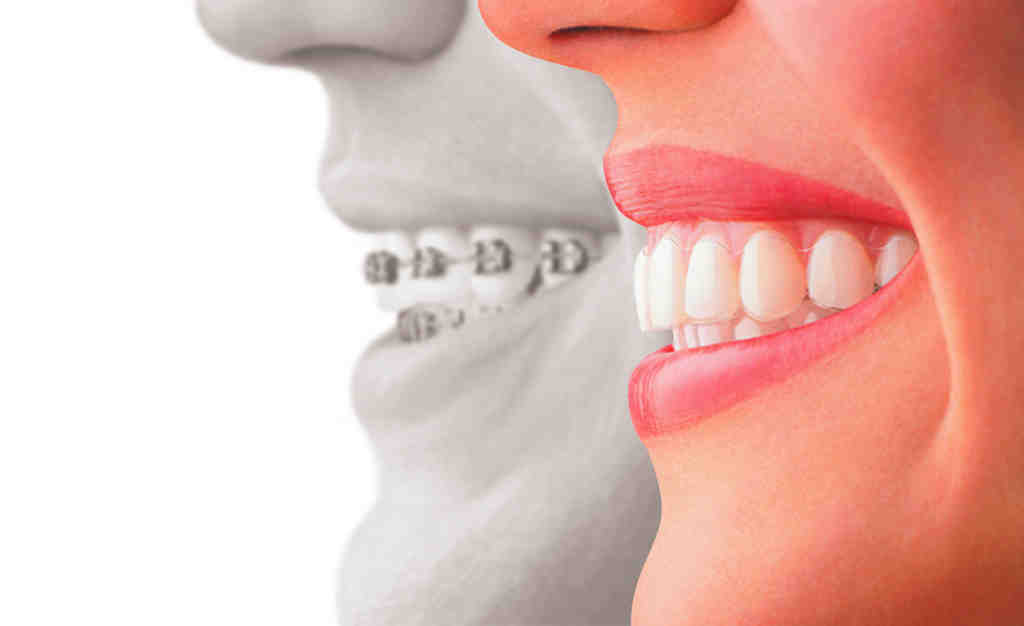 How do you find a good cosmetic dentist?