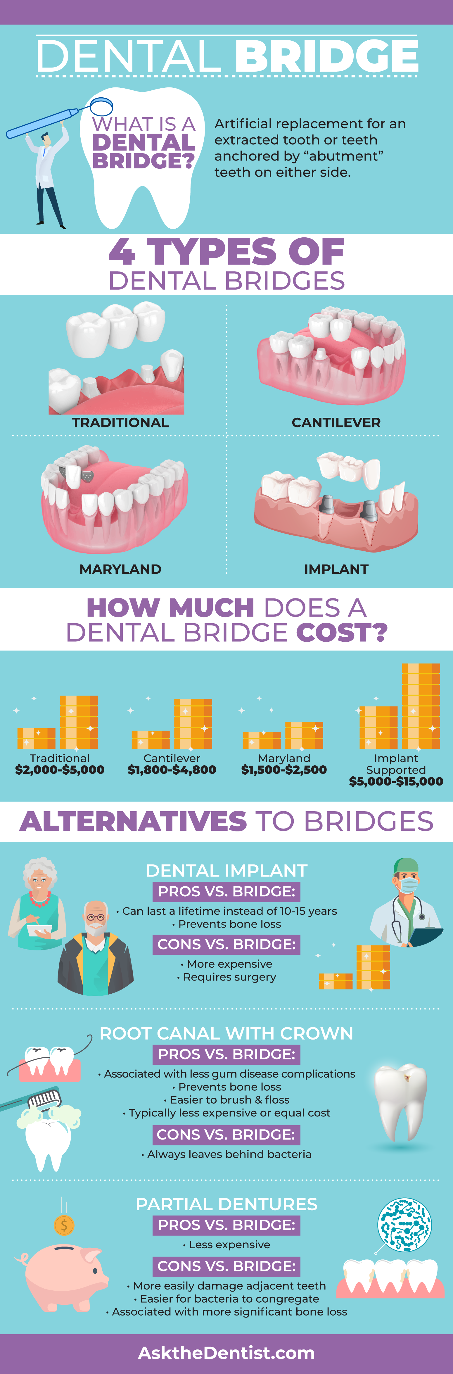 How long do bridge implants last?