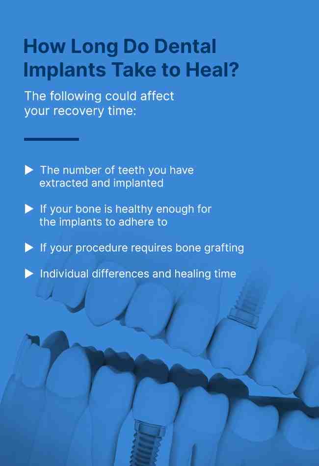 how-long-to-recover-from-dental-implants-dental-news-network