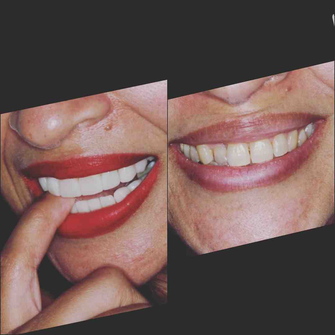 Cosmetic dentistry veneer washington dc Dental News Network