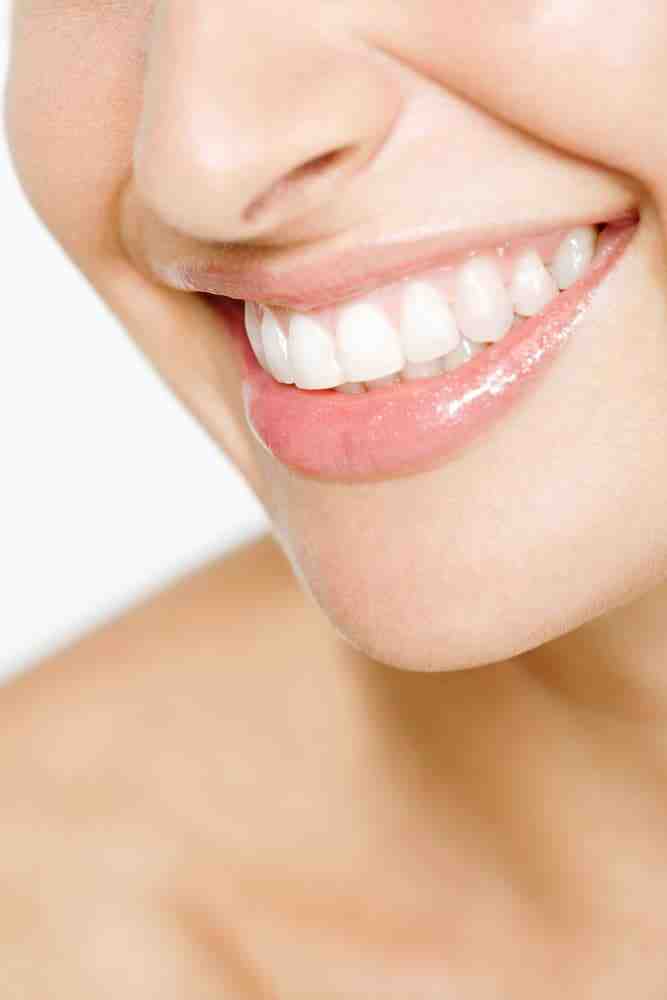 How much does a beautiful smile cost?