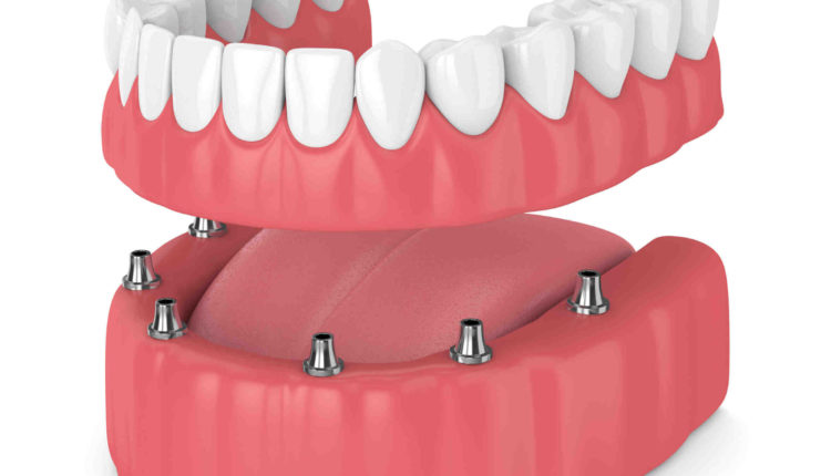 Delta Dental Cover Ct Scan