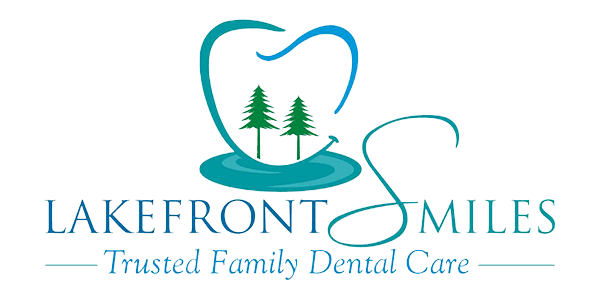 How much does it cost to get a full mouth of dental implants in California?