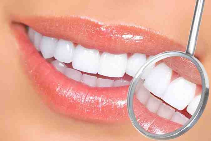 How much does veneer treatment cost?