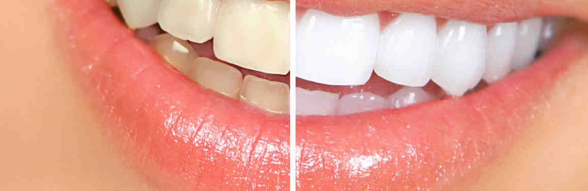 How much is Delta Dental monthly?