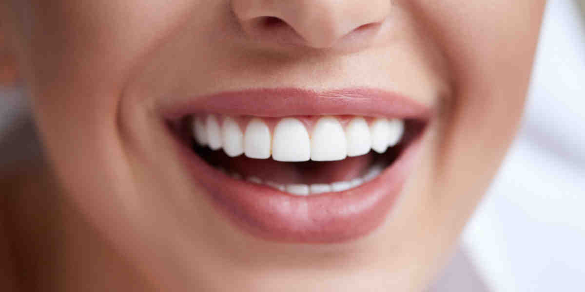 How much should a full set of dental implants cost?