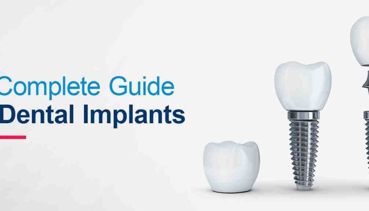 How painful are mini dental implants