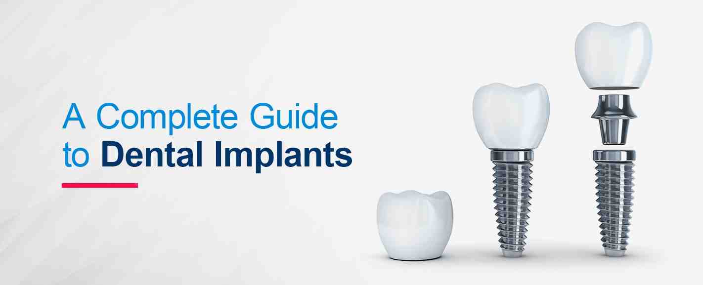 How painful are mini dental implants?