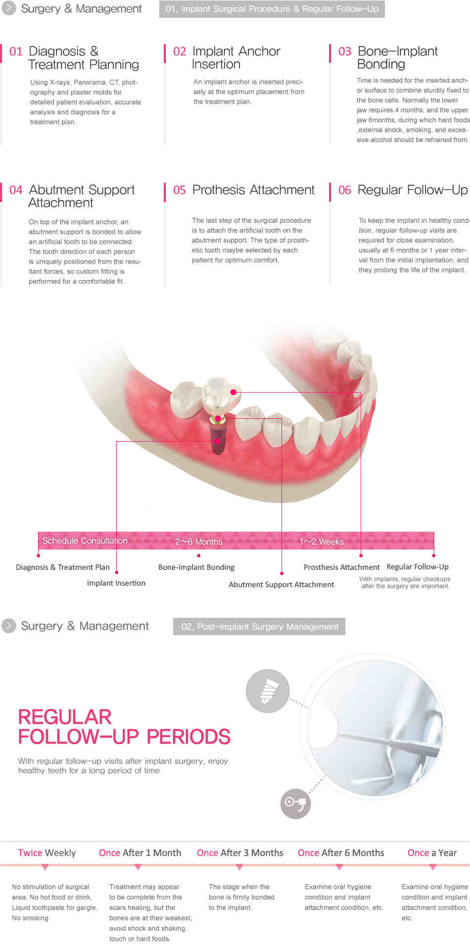 How should a patient care for implants once placed?