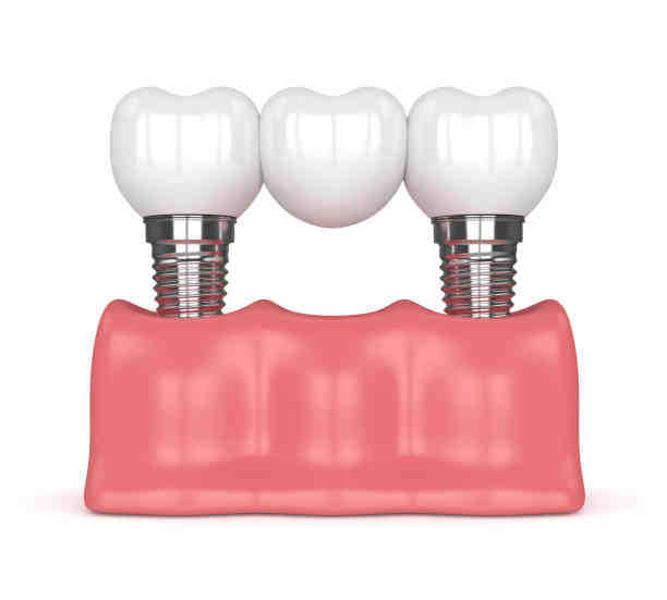 Is Delta Dental HMO or PPO?